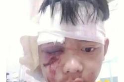 陕西科技大学女孩砍人