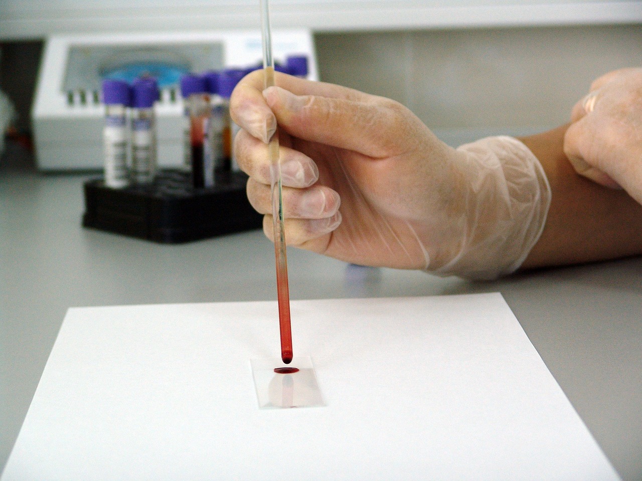 科学家引导HIV叛变，共同对抗艾滋病毒——一种革命性的治疗策略